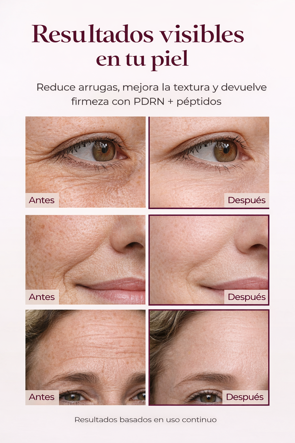 Serum PDRN anti arrugas
